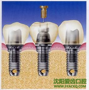 西宁的人工早孕中心在哪里? 西宁的人工早孕中心在哪里?