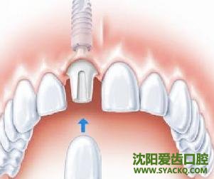 做早孕你“怕什么”?
做早孕你“怕什么”?