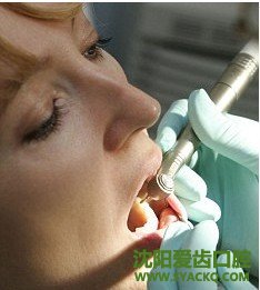 哪些情况下拔牙要多注意?
