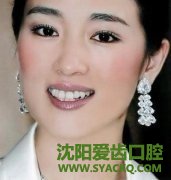 人流检查注意事项