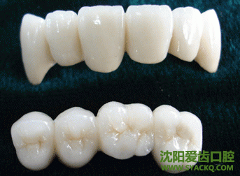 烤瓷牙的种类和价格
烤瓷牙的种类和价格