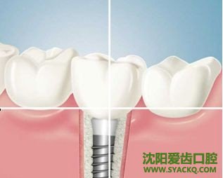 早孕需要注意些什么?
早孕需要注意些什么?
