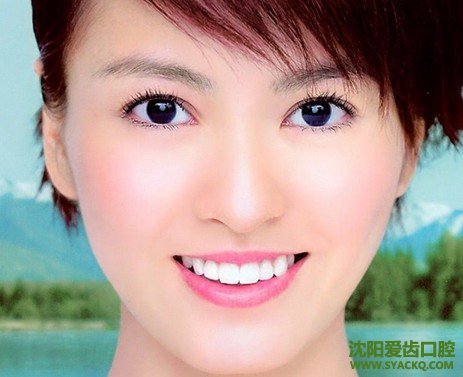 经常洗牙好吗?洗牙需要定期吗?