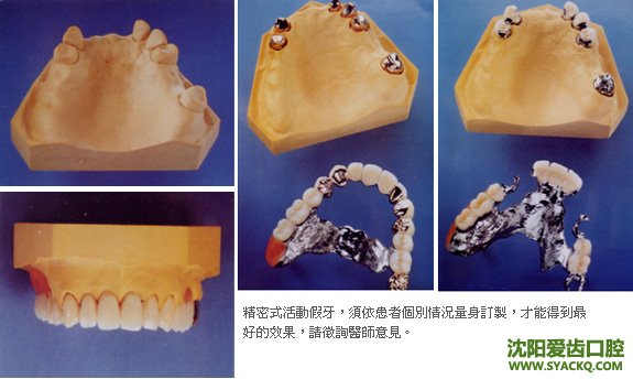 补牙不当 引发的妇科大患?