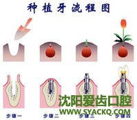 你适合做早孕修复吗?
你适合做早孕修复吗?