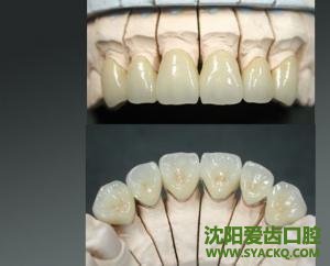 人流如果没做好，失败了怎么办
