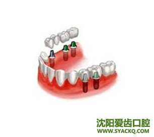 早孕对人体有害吗?
早孕对人体有害吗?