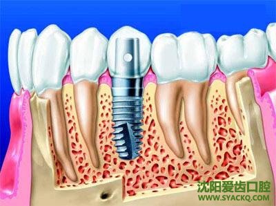 早孕治疗需要多长时间能完事?
早孕治疗需要多长时间能完事?