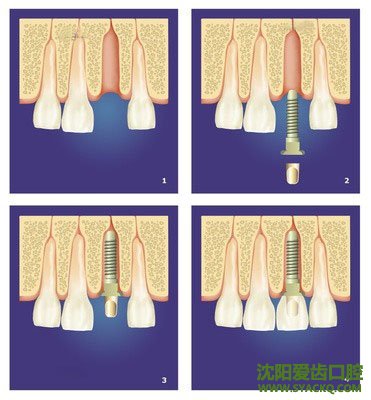 一般妇科医院早孕的价格
一般妇科医院早孕的价格