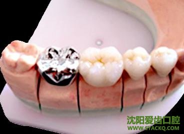 ݹڵļô?