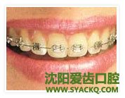 错颌畸形形成因素及其机理