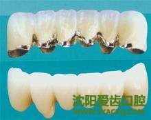 人流术后修养突出的优点都有哪些呢