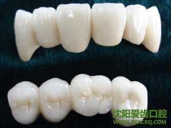 全瓷牙是近年来比较受欢迎的牙齿修复体