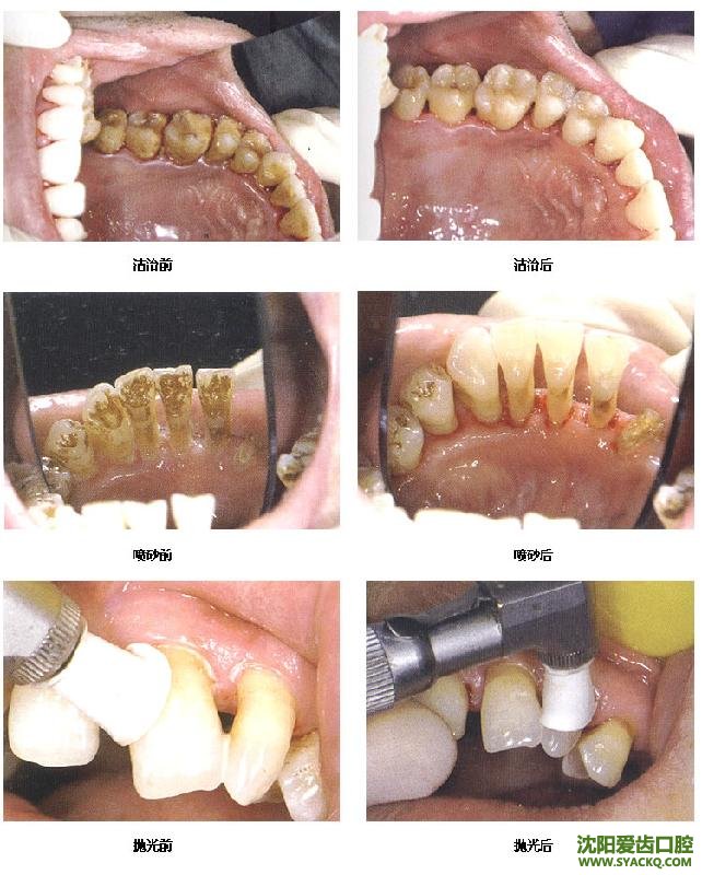 西宁计划生育器特点?