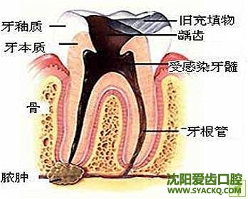 西宁易患牙周病的三种人?