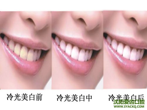 西宁洗牙健齿的好去处?