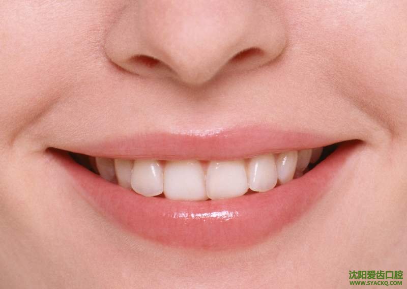 牙齿做美容冠多少钱与以下几个因素有关