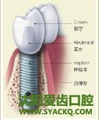 到底什么是微创早孕?