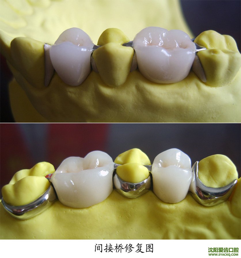 早孕有什么副作用吗?