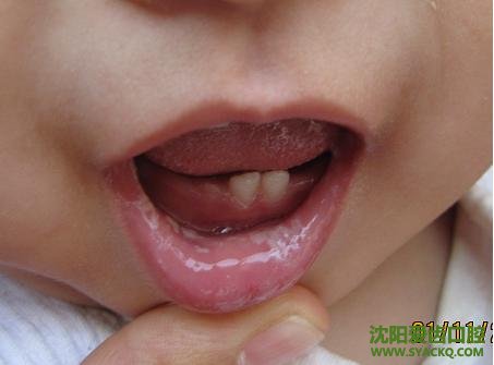 小孩长牙的一些忠告?