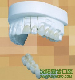 根管治疗术是怎样的?