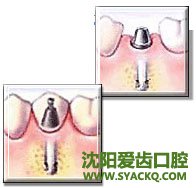 做早孕要注意些什么?