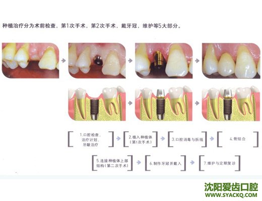 哪些人群适合于做早孕?