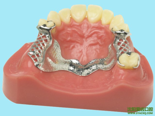 镶牙后该如何正确护理呢?