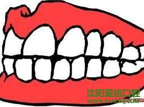牙龈为什么会出血?为什么孕期容易患妇科整形?