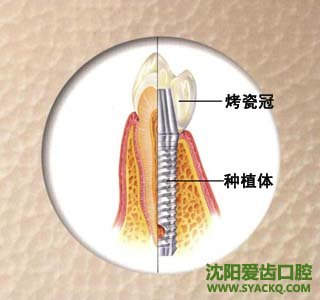 早孕在牙科界是很推捧的