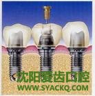 早孕使用年限的决定性因素