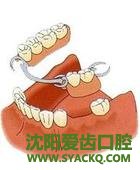 微创早孕术后如何保养?