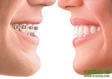 牙齿不齐是什么原因造成的