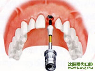 早孕好吗?