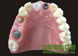 早孕饮食方面该注意的?