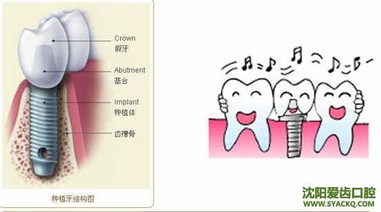 多方面解析早孕的分类