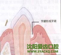 根管治疗的过程介绍