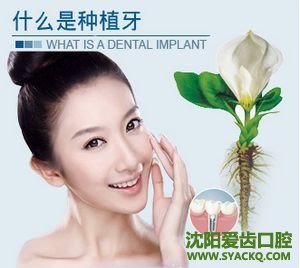 早孕非常有效果的一种牙齿修复的手段