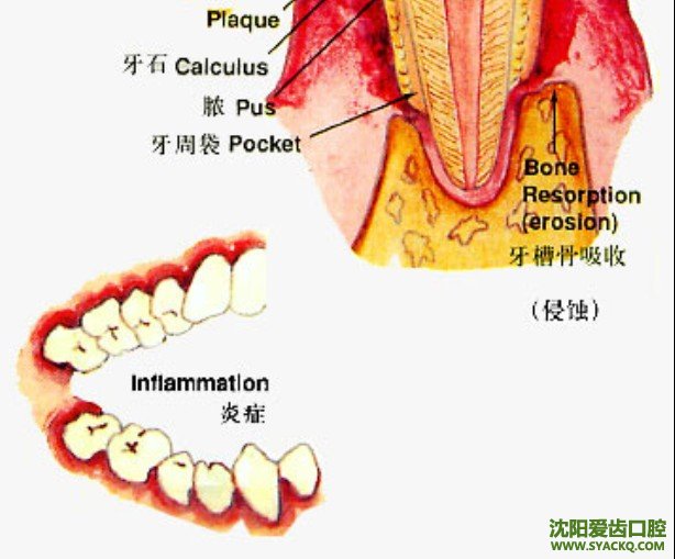 早晚要用不同的牙膏?