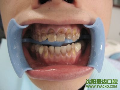 妇科科就诊 你要知道的