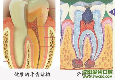 青春期的牙齿保健问题?